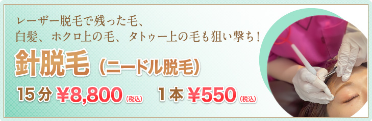ニードル脱毛