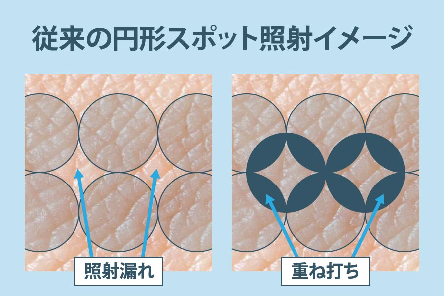 ジェントルレース