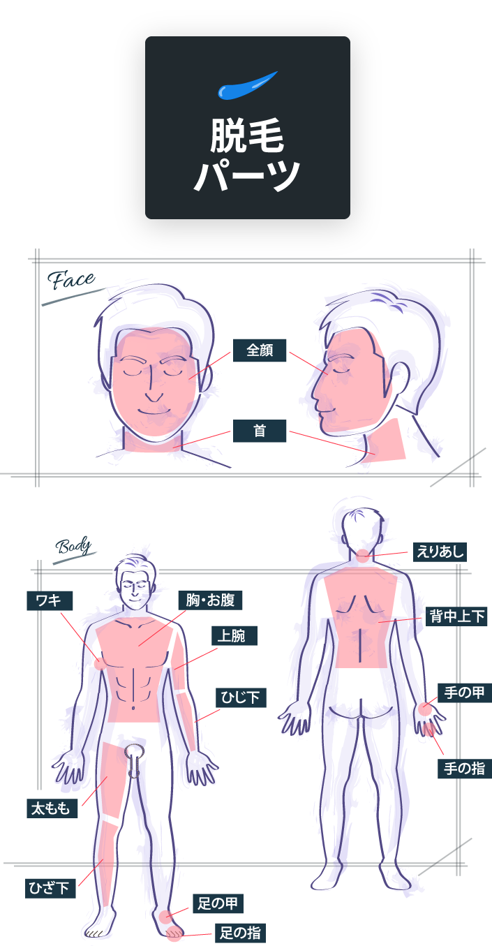 脱毛パーツ